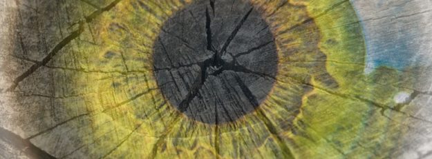 dryeye